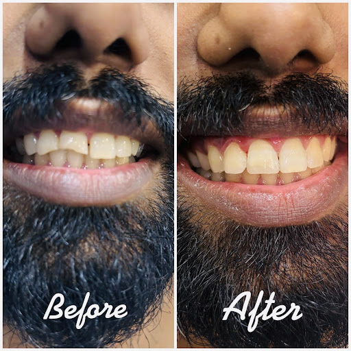 Dental Remedy treatment photo 1