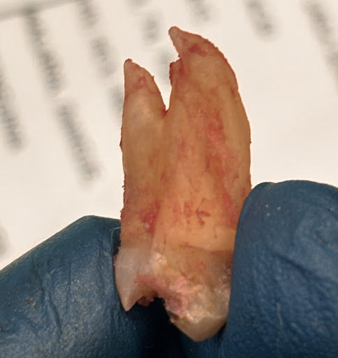 Dental Remedy treatment photo 10