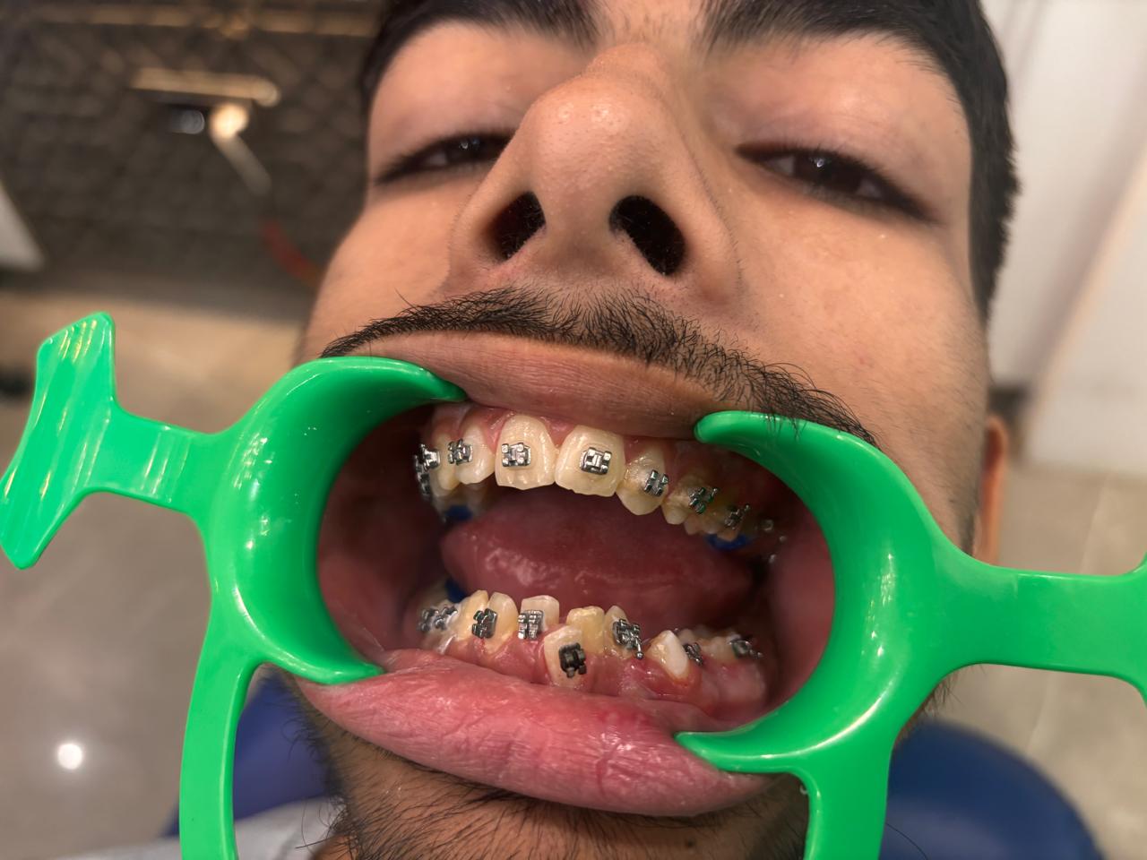 Dental Remedy treatment photo 22
