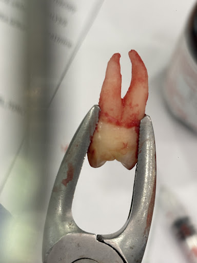Dental Remedy treatment photo 3