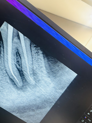 Dental Remedy treatment photo 4
