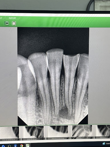 Dental Remedy treatment photo 5