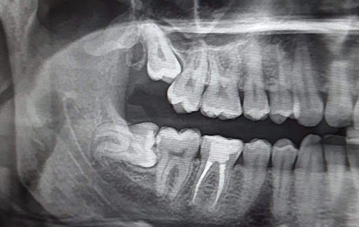 Dental Remedy treatment photo 6