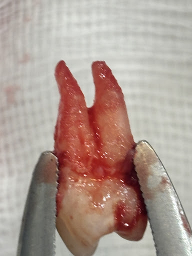 Dental Remedy treatment photo 7