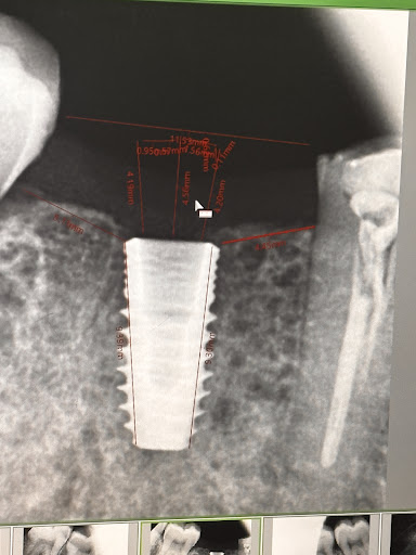 Dental Remedy treatment photo 8